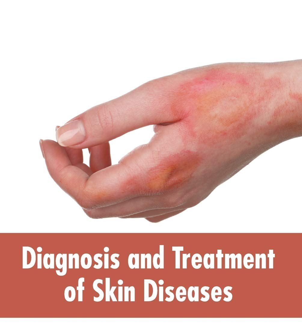 Skin Diseases